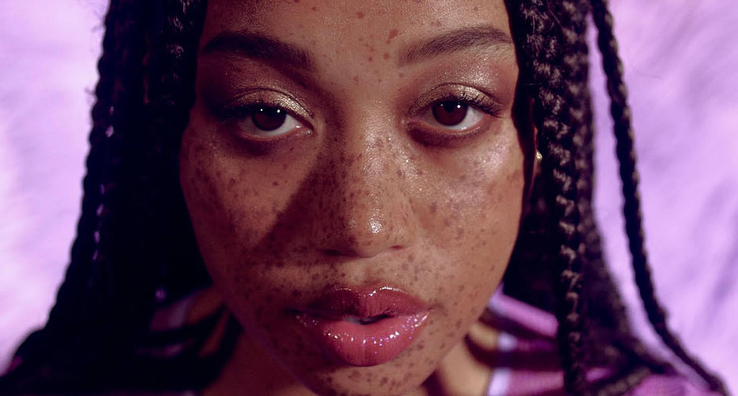 Ebony With Freckles